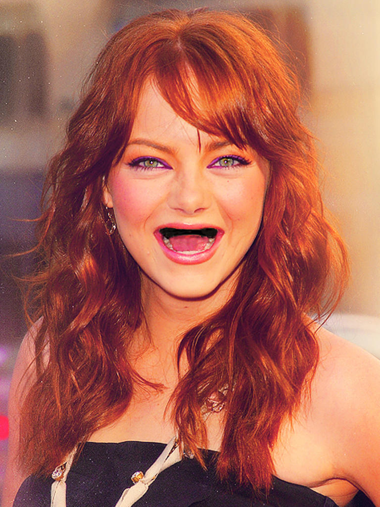 emma-stone-sin-dientes