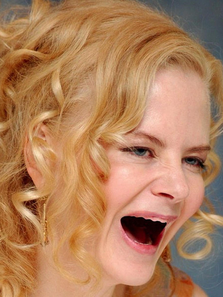 nicole-kidman-sin-dientes