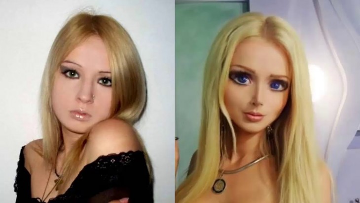 La-Barbie-humana-antes-y-despues-de-operarse-2