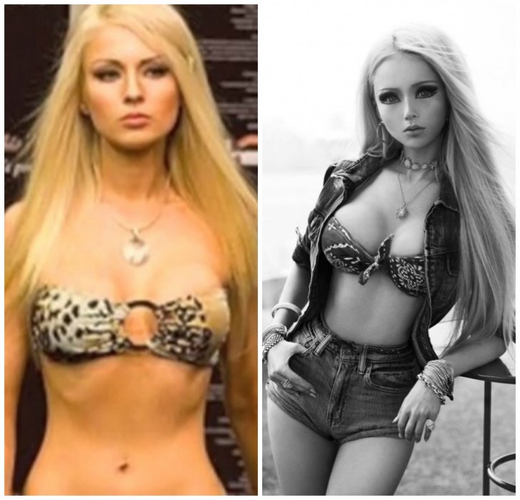 La-Barbie-humana-antes-y-despues-de-operarse